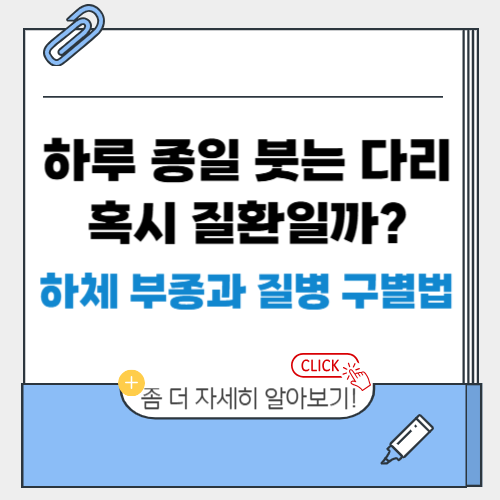 하루 종일 붓는 다리, 혹시 질환일까? 하체 부종과 질병 구별법